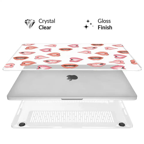 Nude Lips MacBook Case
